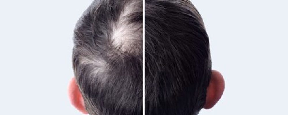 Is hair cream good for men?